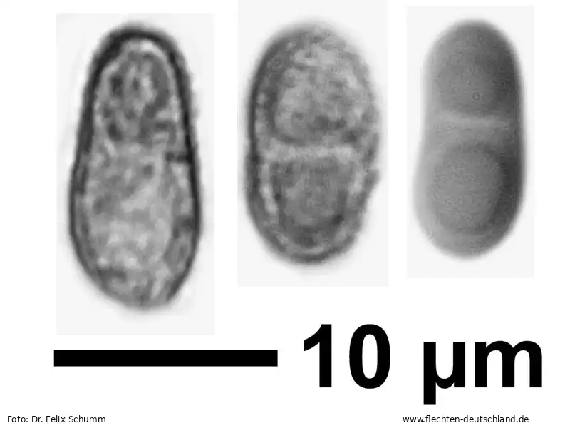 Querschnitt Fruchtkörper | Foto von Dr. Felix Schumm