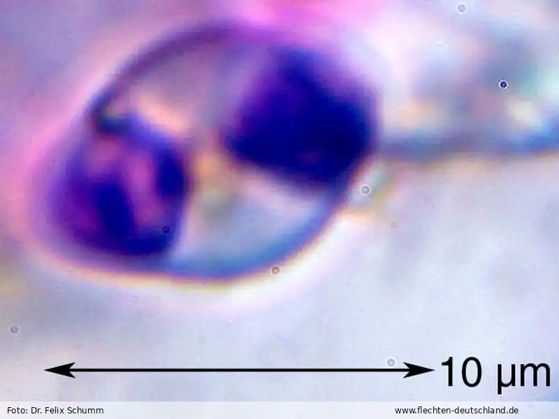 Querschnitt Fruchtkörper | Foto von Dr. Felix Schumm