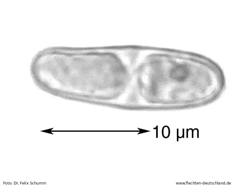 Querschnitt Fruchtkörper | Foto von Dr. Felix Schumm