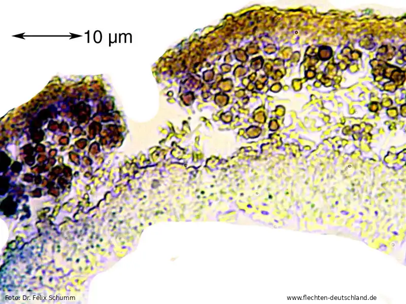 Mikromerkmale | Foto von Dr. Felix Schumm