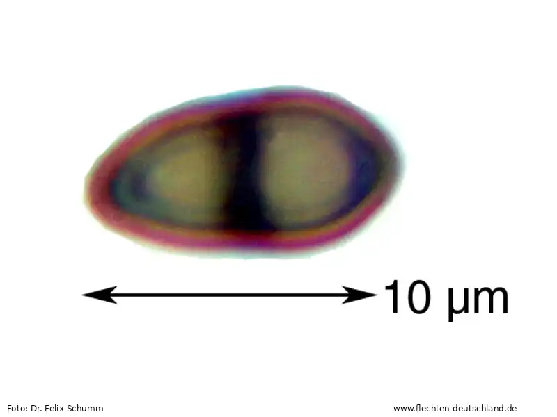 Querschnitt Fruchtkörper | Foto von Dr. Felix Schumm