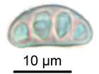 Diplotomma alboatrum (Hoffm.) Flot.