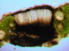 Endococcus fusiger Th. Fr. & Almq.