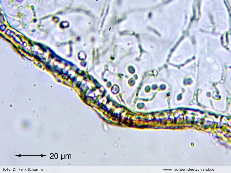 Mikromerkmale | Foto von Dr. Felix Schumm