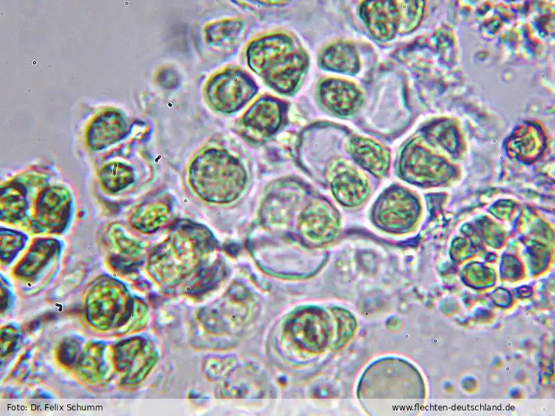 Mikromerkmale | Foto von Dr. Felix Schumm