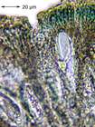 Mycoblastus affinis (Schaer.) T. Schauer