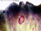 Ochrolechia szatalaensis Verseghy