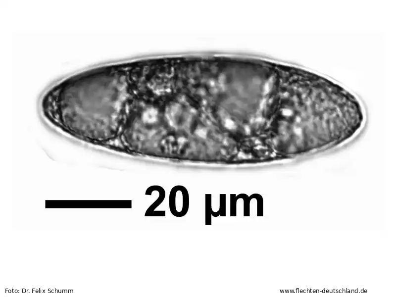 Sporen | Foto von Dr. Felix Schumm