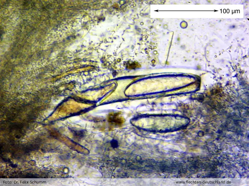 Ascus/Basidie | Foto von Dr. Felix Schumm