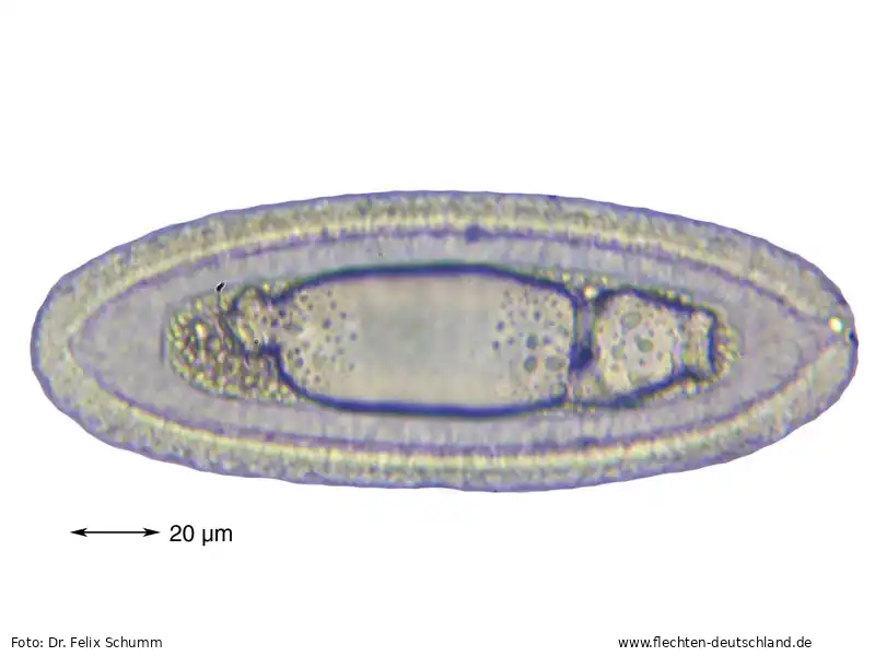 Sporen | Foto von Dr. Felix Schumm