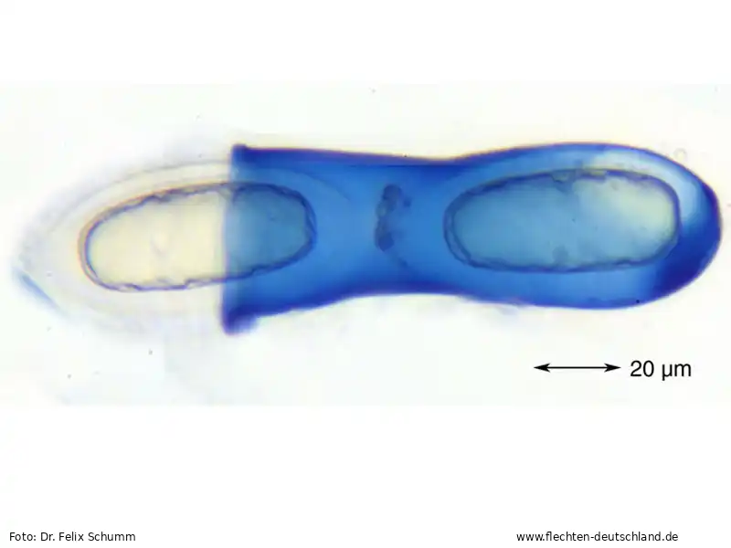 Ascus/Basidie | Foto von Dr. Felix Schumm