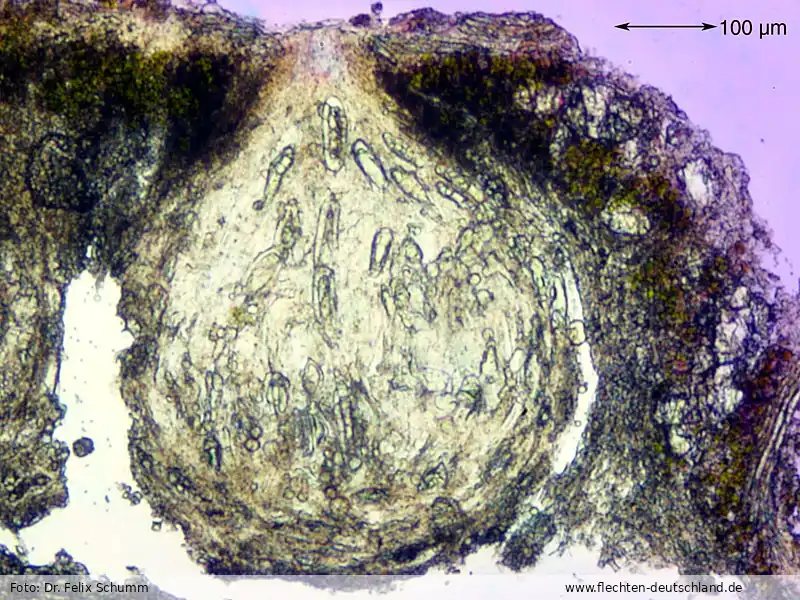 Querschnitt Fruchtkörper | Foto von Dr. Felix Schumm